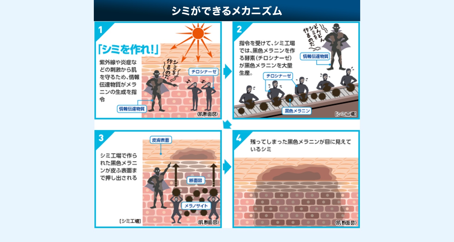 シミができるメカニズム