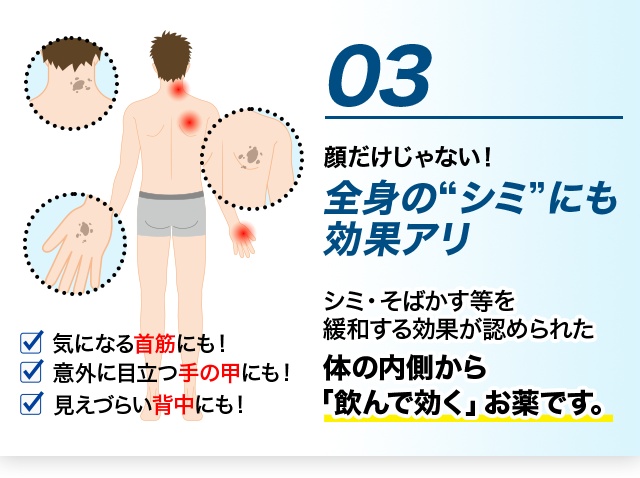 03 顔だけじゃない！全身の“シミ”にも効果アリ シミ・そばかす等を緩和する効果が認められた体の内側から「飲んで効く」お薬です。