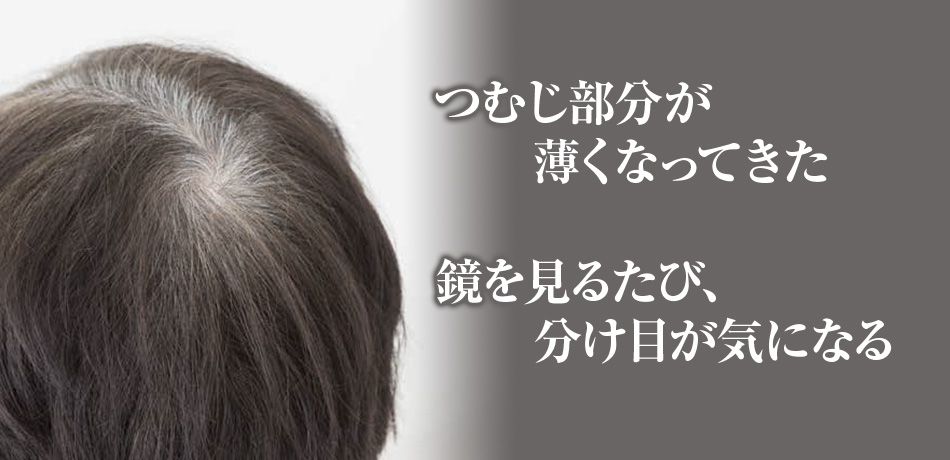 つむじ部分が薄くなってきた 鏡を見るたび、分け目が気になる