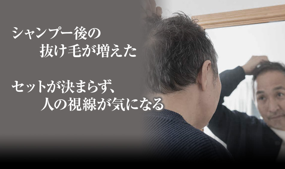 シャンプー後の抜け毛が増えた セットが決まらず、人の視線が気になる