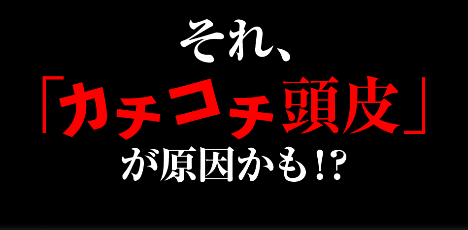 「カチコチ頭皮」が原因かも!?