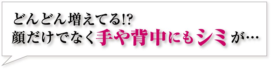どんどん増えてる！？顔だけでなく手や背中にもシミが・・・
